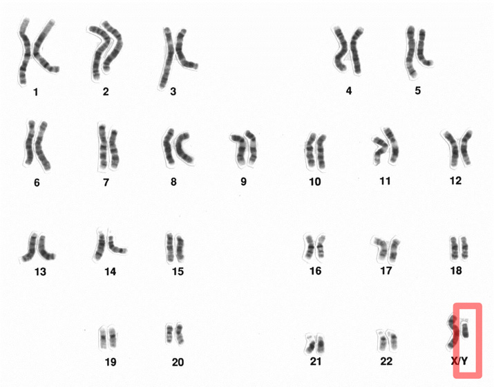 Y Dna Test What Is A Y Chromosome Test And Which Is Best